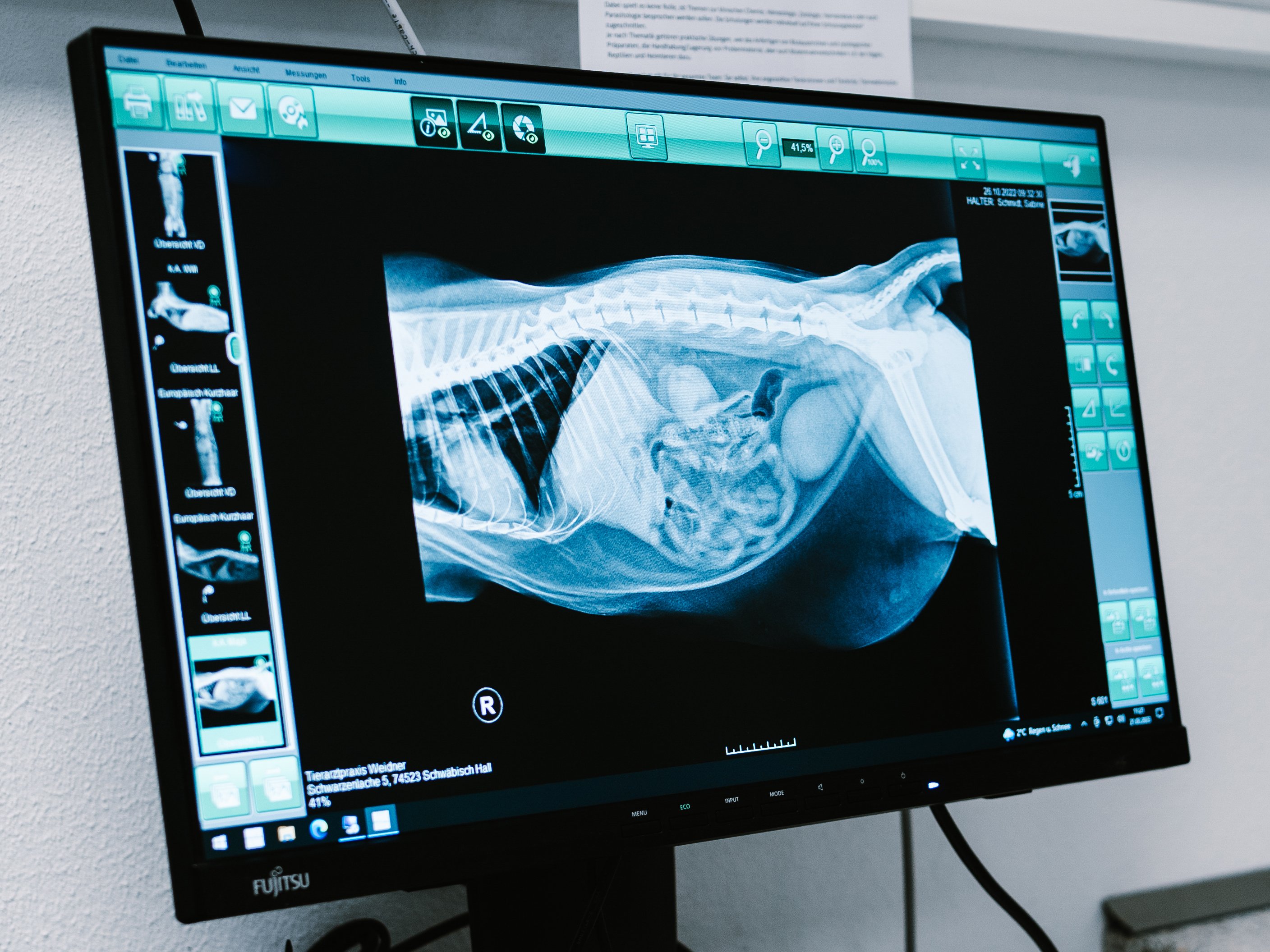 Röntgenbild auf Monitor